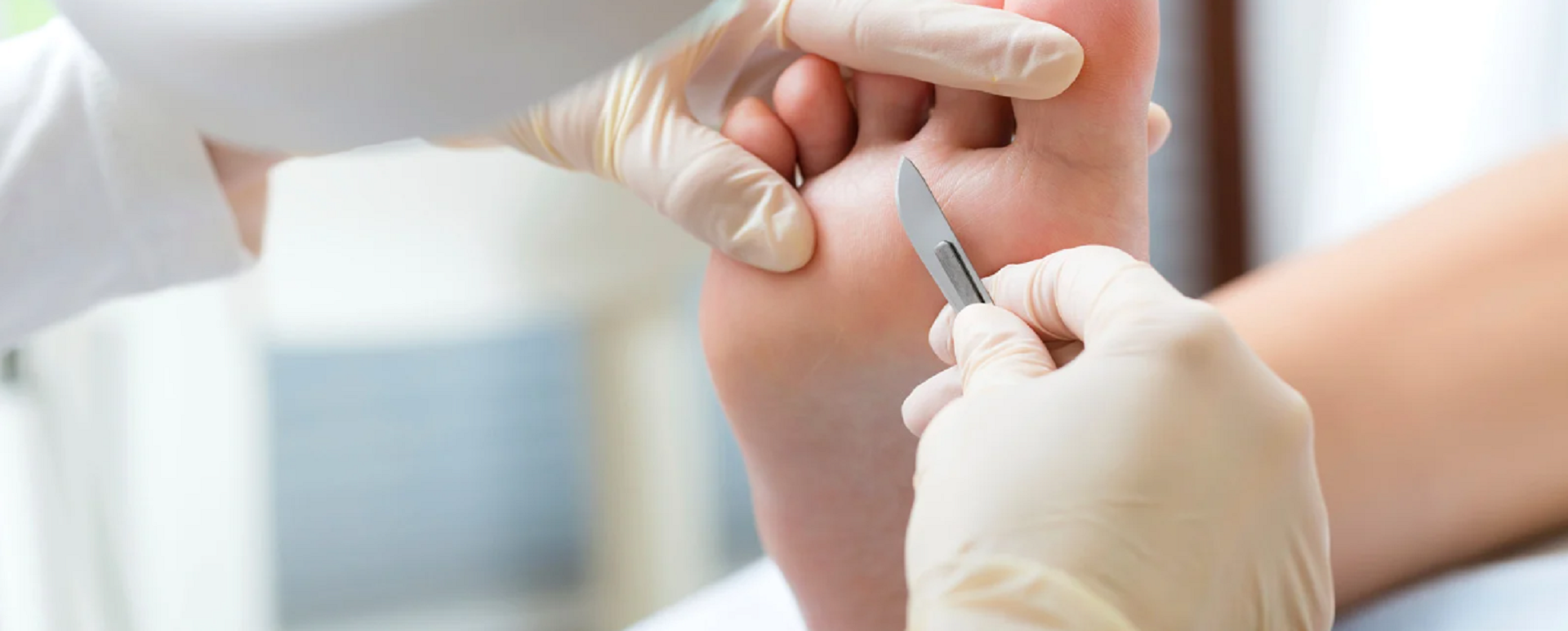 SPORTS PODIATRY IN LONDON